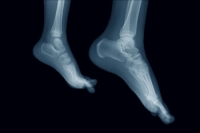 The Structure of the Foot