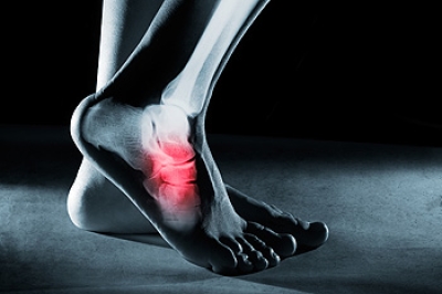 Causes and Diagnosis of Foot Stress Fractures