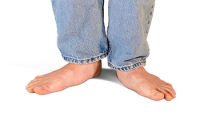 Symptoms and Causes of Flat Feet