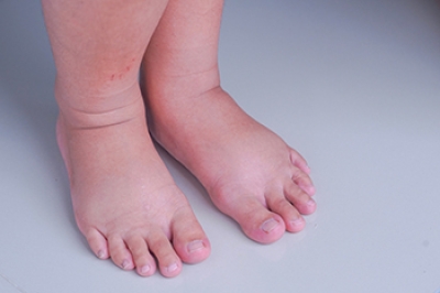 Do Feet Grow During Pregnancy?