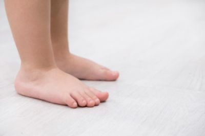 Flat Feet in Children