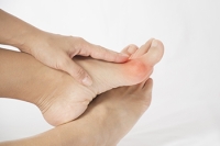 The Frequency of Bunions